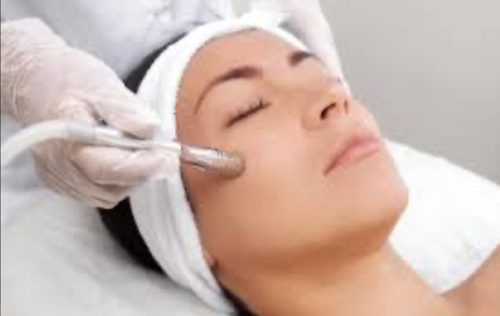 Microdermabrasion Facial w/ Vit C