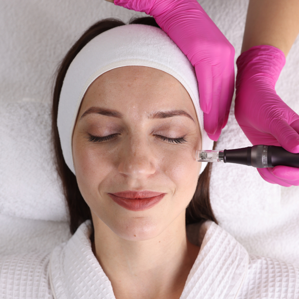 Microneedling at Southern Beauty Aesthetics in Marion, IL