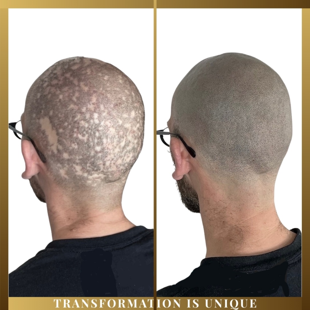 SMP Mini / Spot Fill