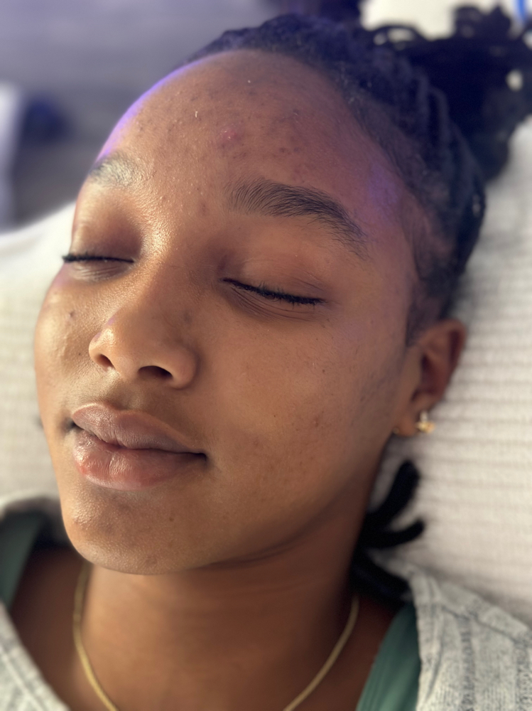 Teen Facial (ages 12-17)