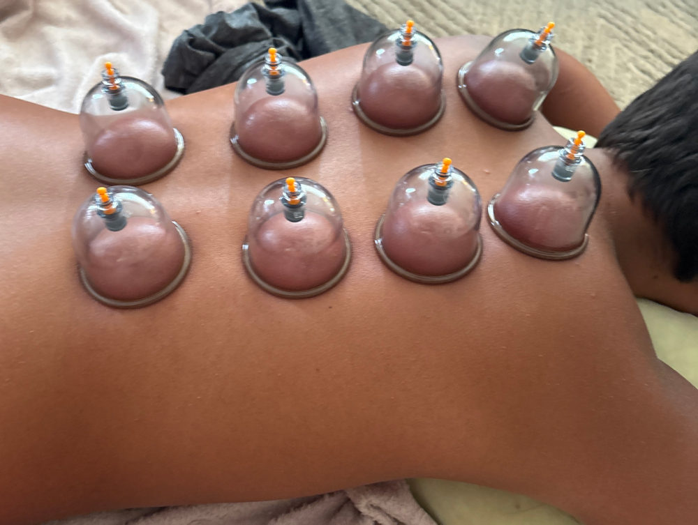 20 Min Cupping at A Moment for U Massage in Seymour, IN