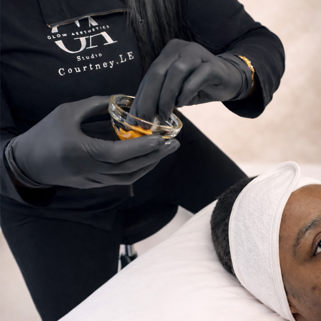 Microneedle + Chemical Peel at Glow Aesthetics Studio in Atlanta, GA