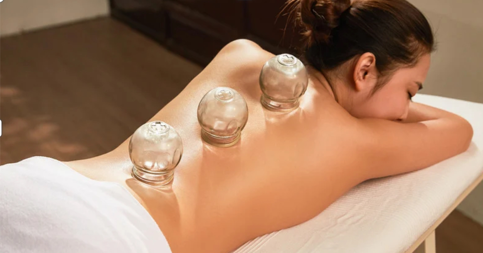 Cupping Therapy