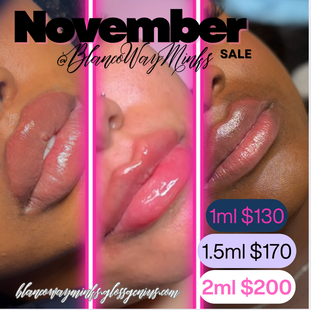 November Lip Filler Sale