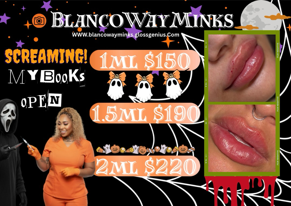 October Lip Filler Sale