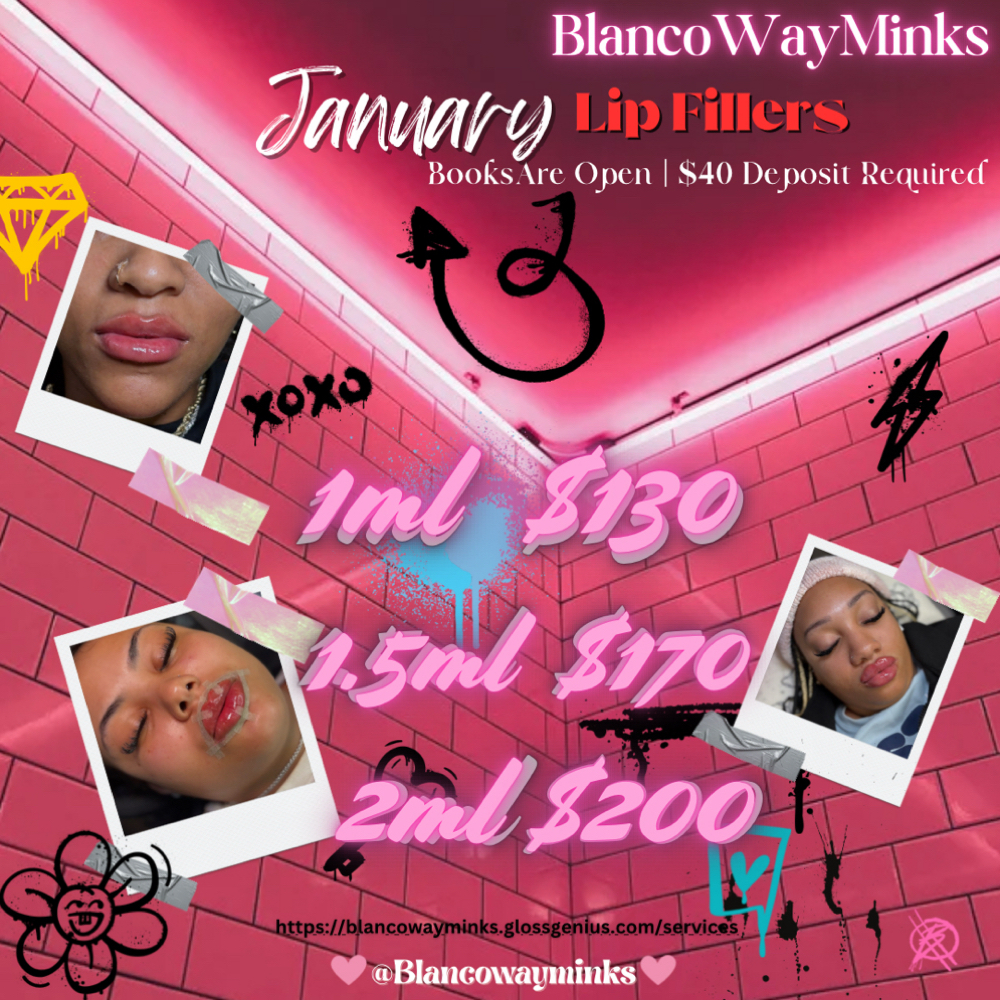 February Lip Filler Sale