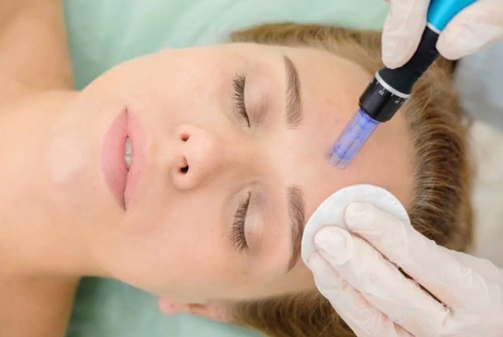 Microneedling AnteAGE GF/Stem / LED