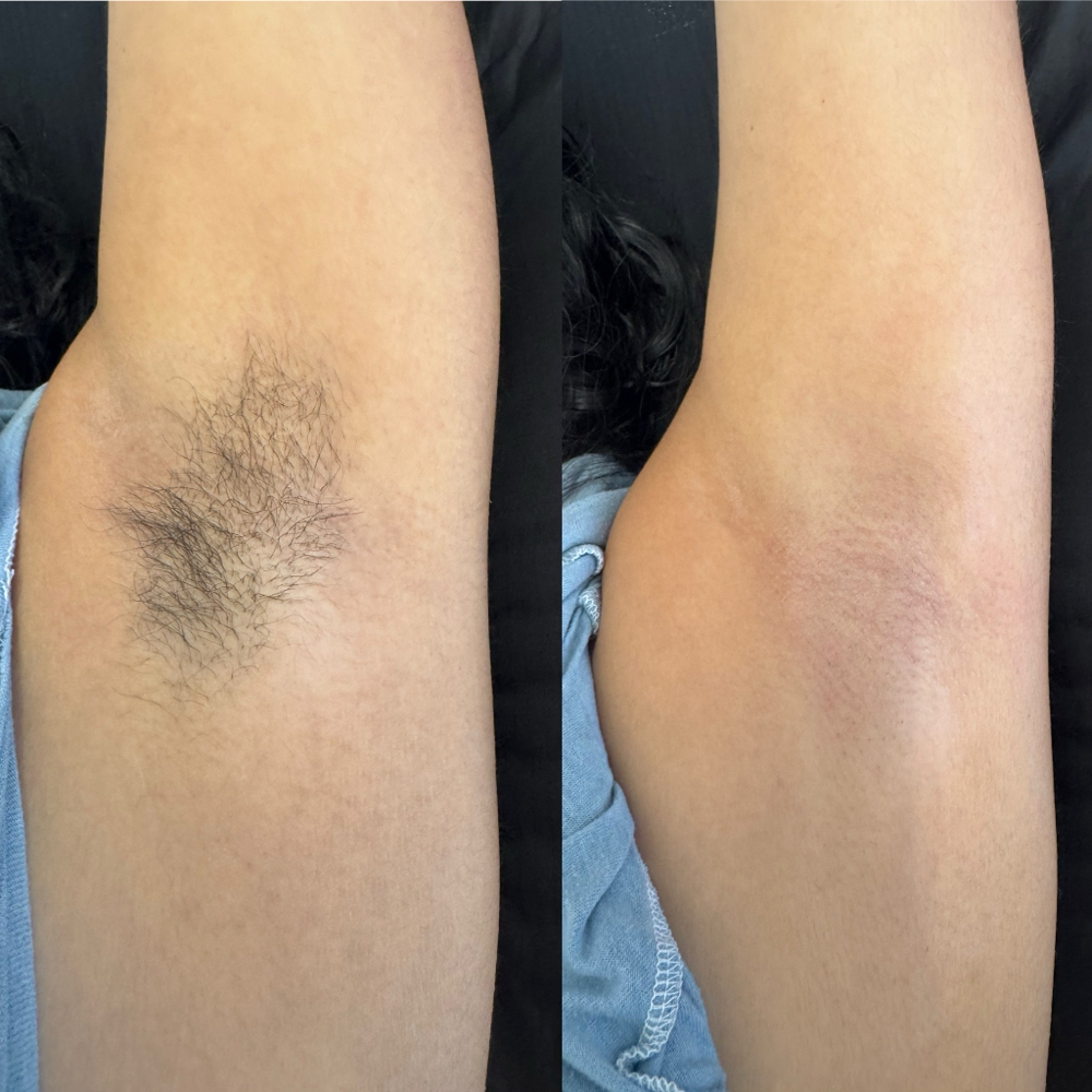 💓Underarm Wax at Skiin Pro Studio in Baldwin Park, CA