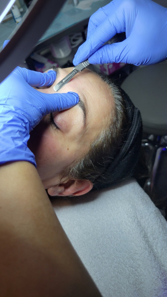 Dermaplaning Facial