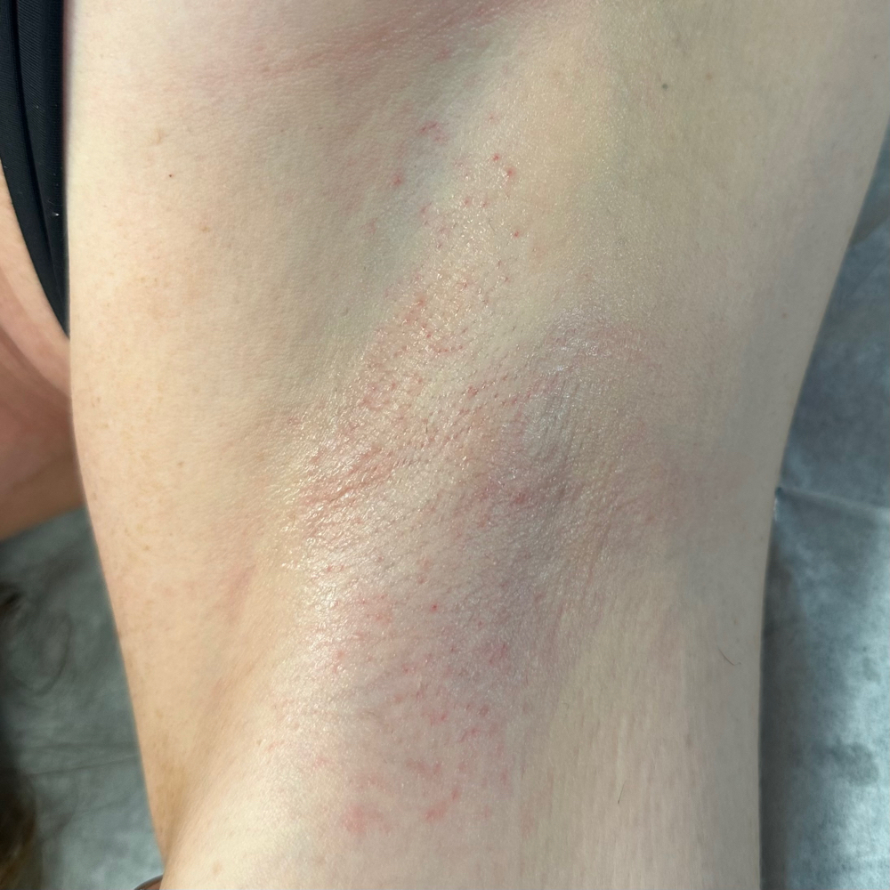 Armpit Wax