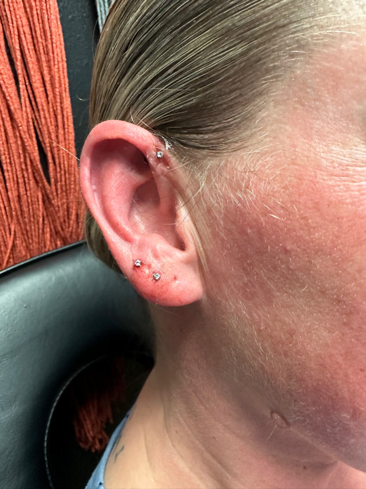 Forward Helix