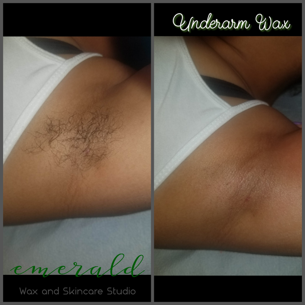 Underarm Wax