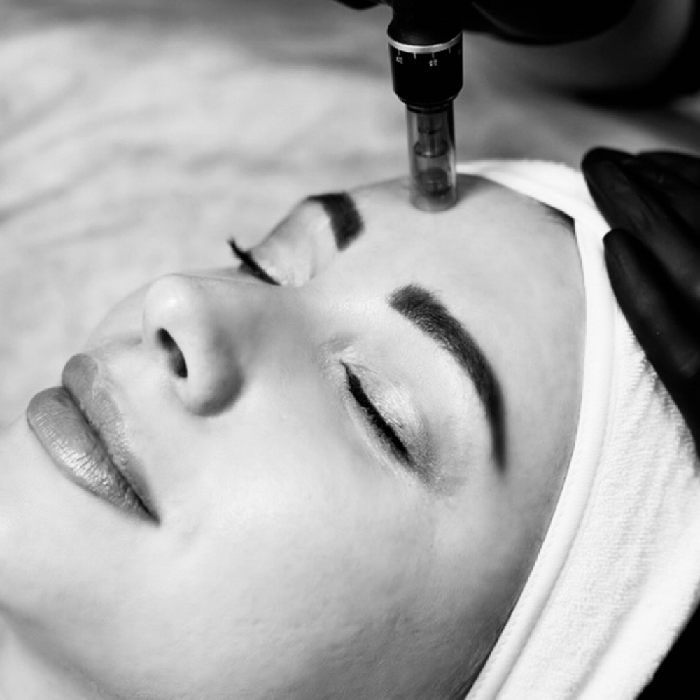 Express Microneedling at Beauty by Makenna in Lincoln, NE