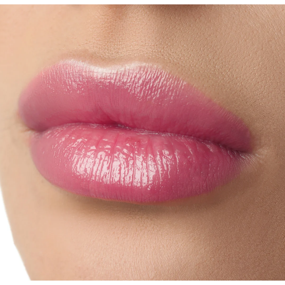 3 ML Needle-Less Lip Filler