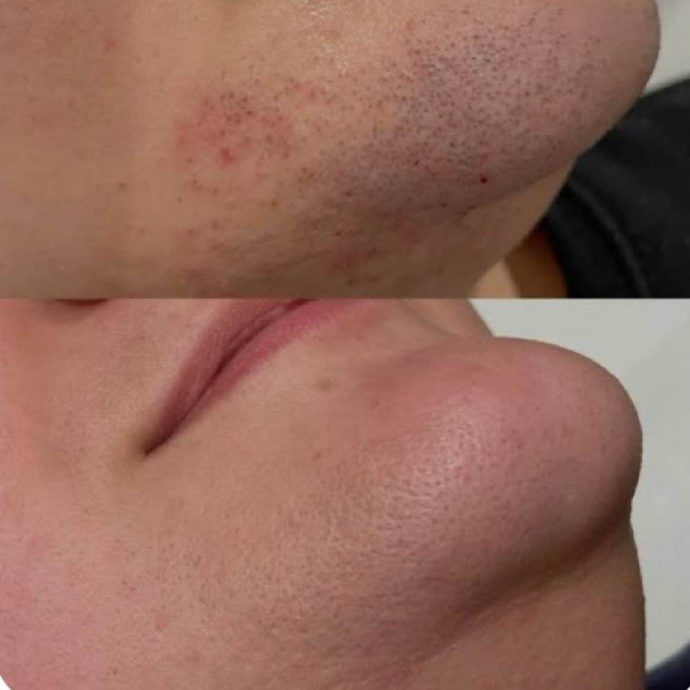 Chin/ Below Chin Wax at West View Salon & Spa in Fairview Park, OH