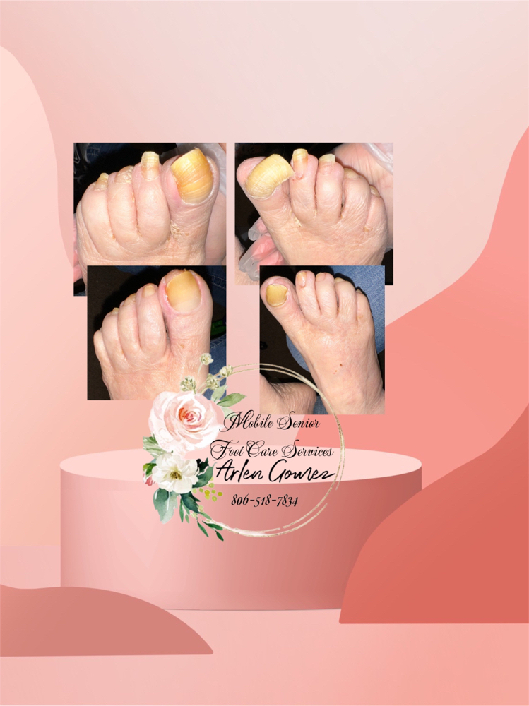 Location In Lubbock- Foot care
