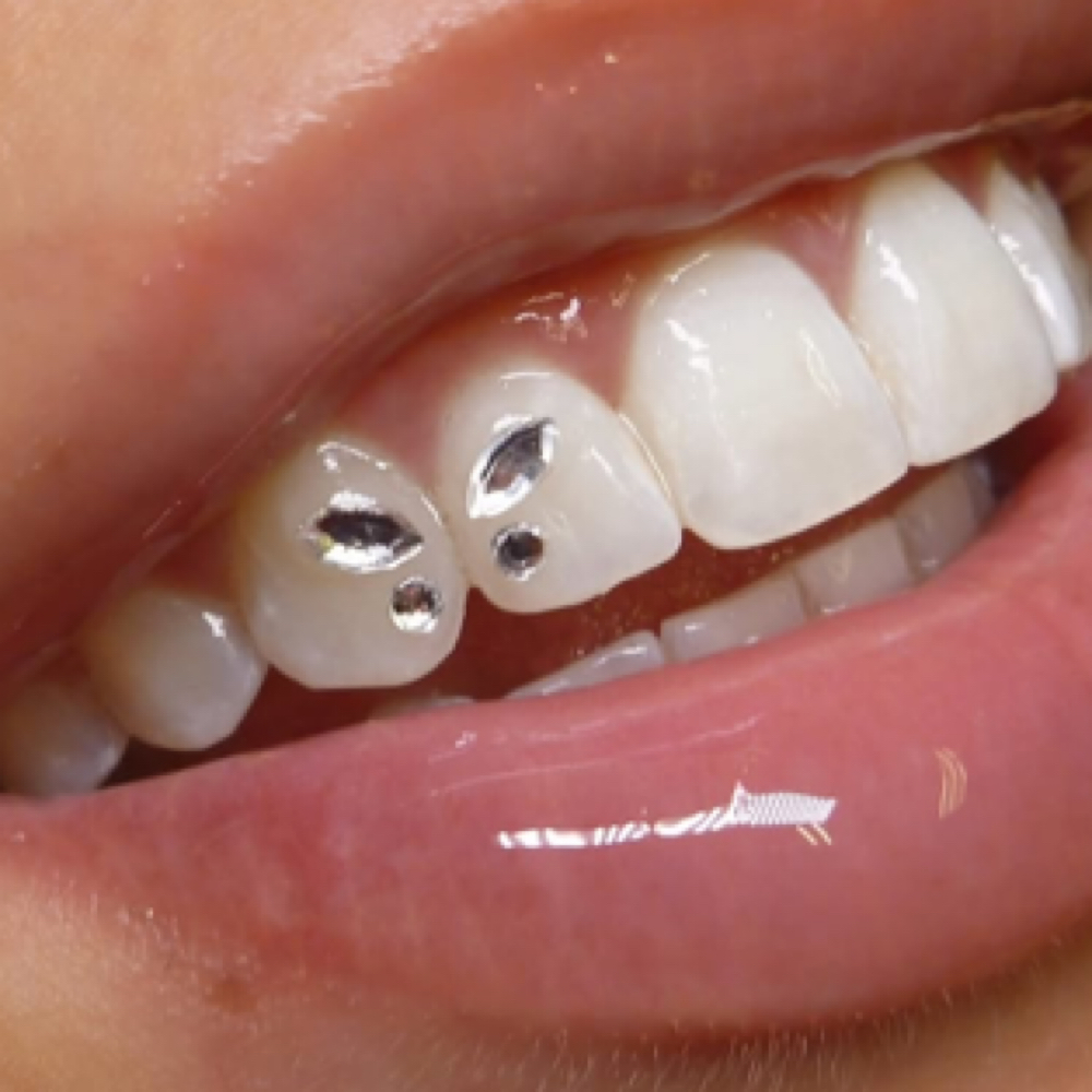 Single Tooth Gem Design at Glamour Glow, LLC in Columbus, NE