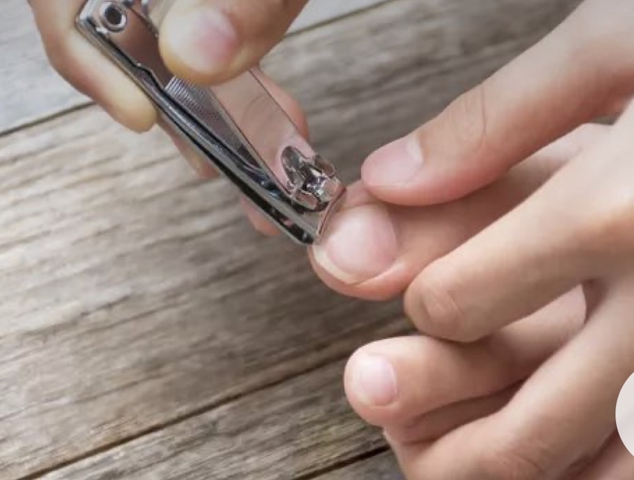Toe Nail Trim