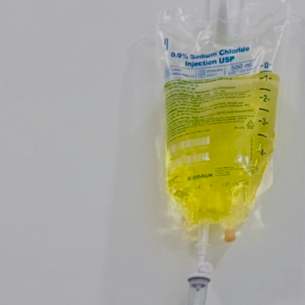 IV Therapy at Glow N Go Beauty in Los Alamitos, CA