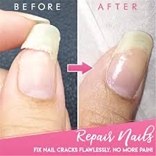 Nail repair