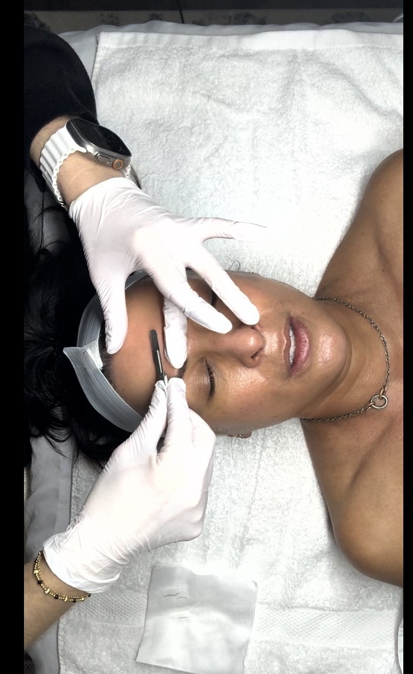 Dermaplane Add On