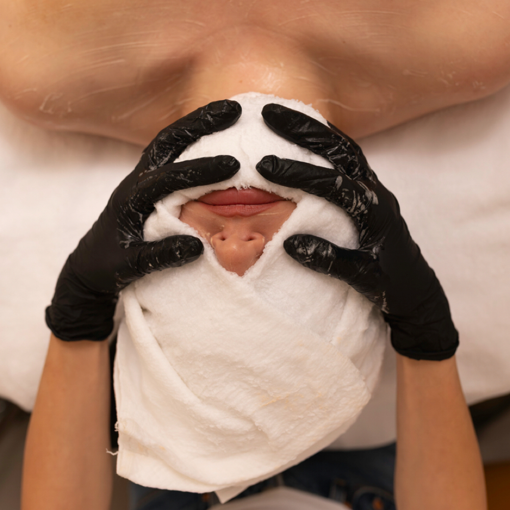 Acne Maintenance Treatment at The Skin Method in Overland Park, KS