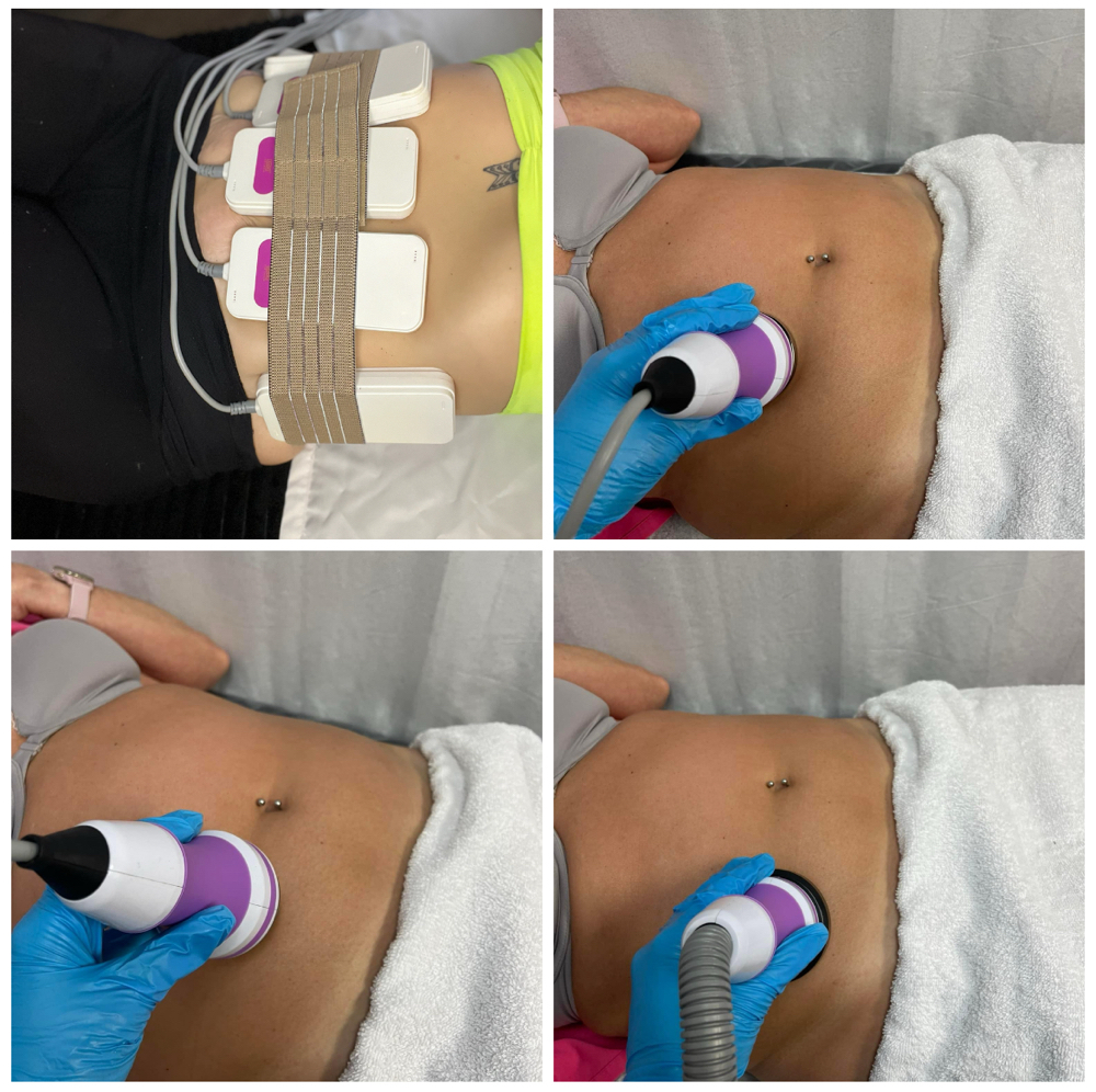 Body Contouring 3 Sessions