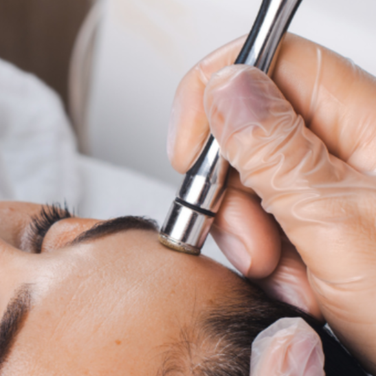 Microdermabrasion at Brinley Campbell in Jasper, AL