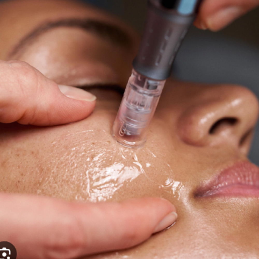 Targeted NanoFusion Treatments at Jay Lash LLC in buffalo, NY