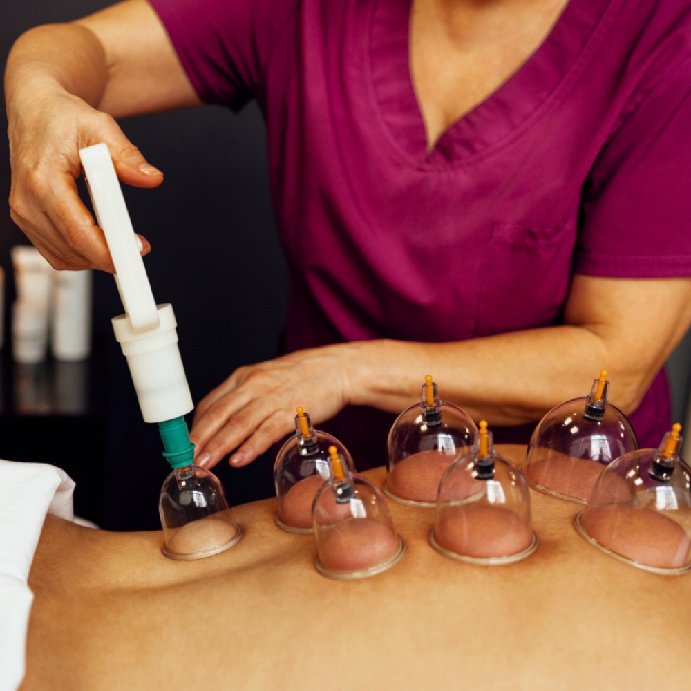 Cupping at Greenway Stretch & Massage Therapy in Greensboro, NC
