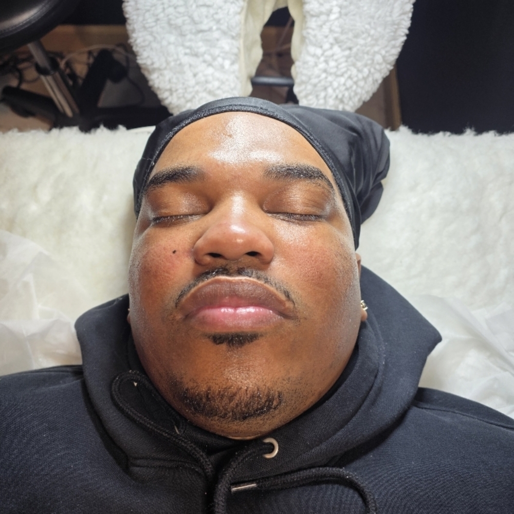 Dark Spot Correction Facial at 829 Esthetics in Milwaukee, WI