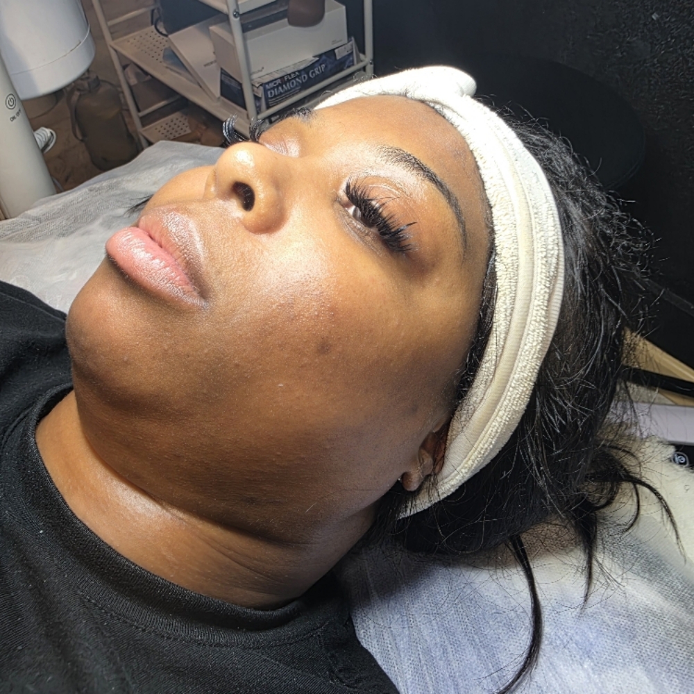Dark Spot Correction Facial at 829 Esthetics in Milwaukee, WI