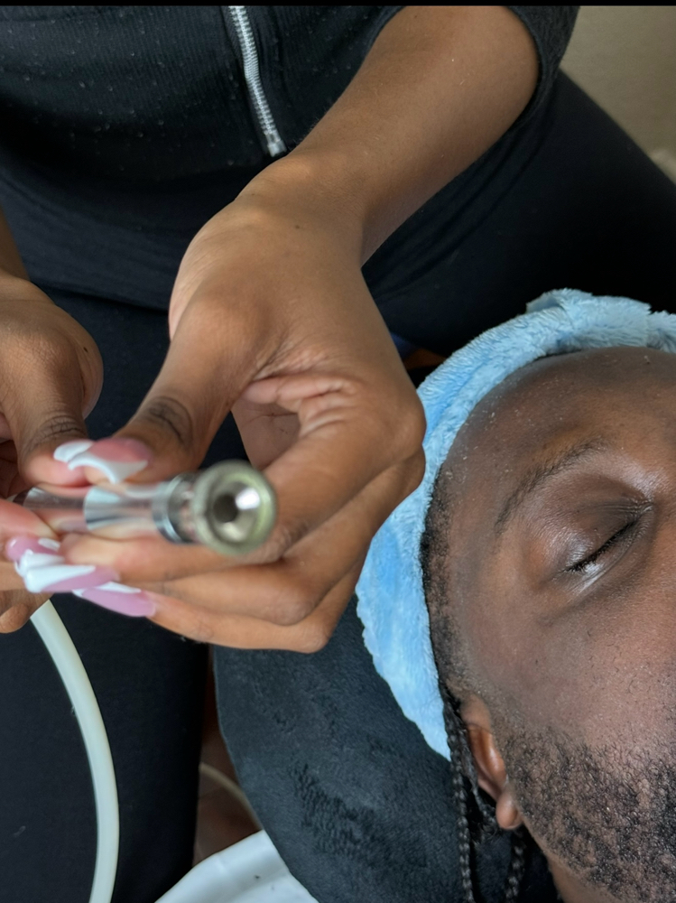 Microdermabrasion (ADD-ON ONLY)