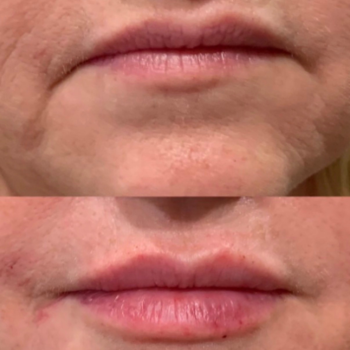 Resting “I’m Actually Fine” Face at Radiant Aesthetics by Liz in El Paso, TX