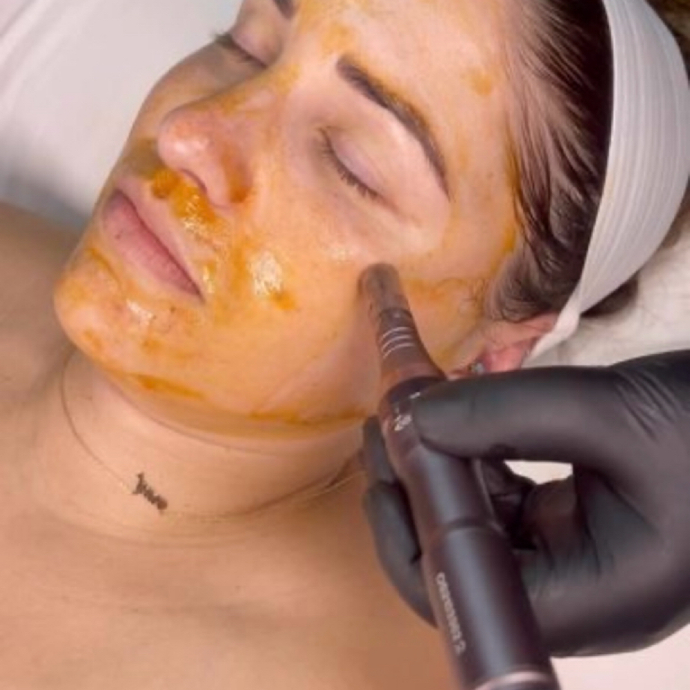 Korean Nano Infusion Facial at Glow Beauty Lounge in New Concord, OH