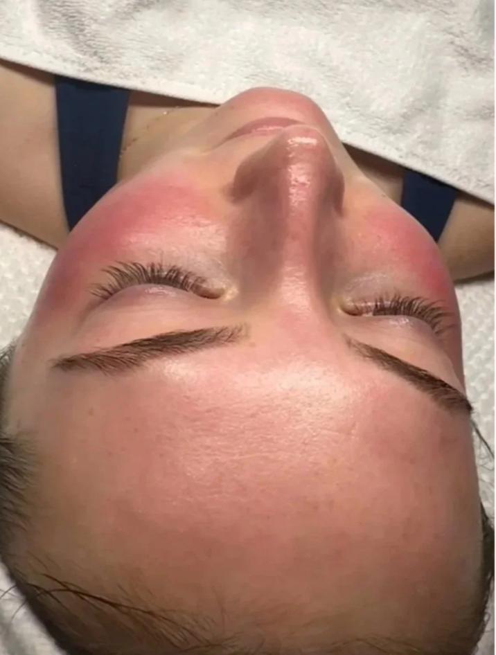 Custom Regenerative Facial