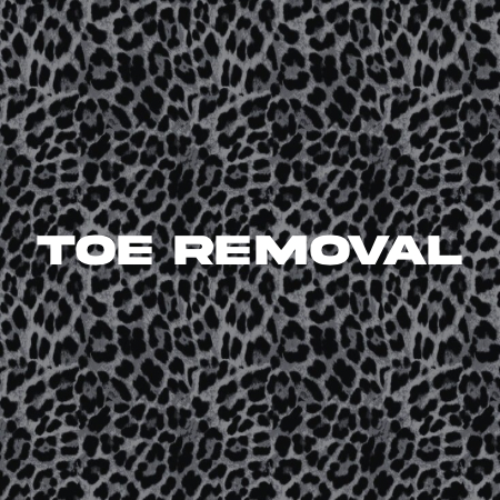 Toe Removal