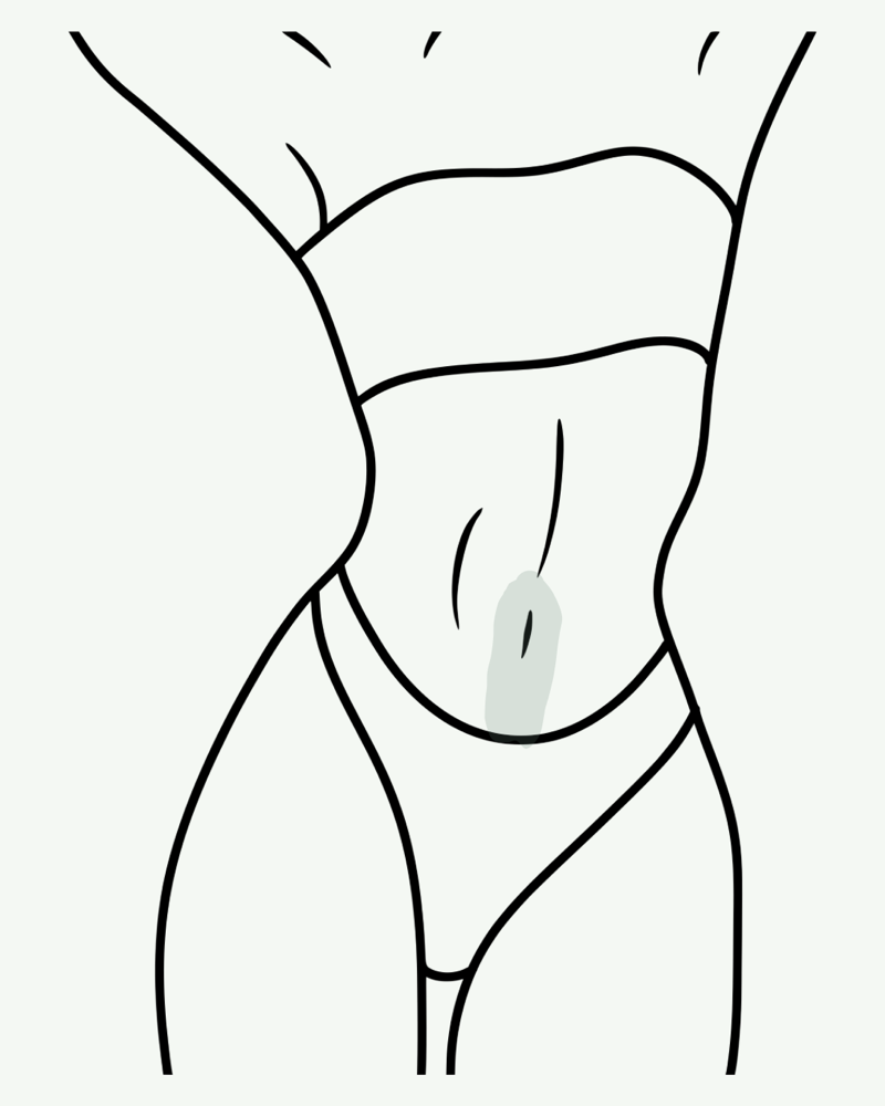 Stomach Strip