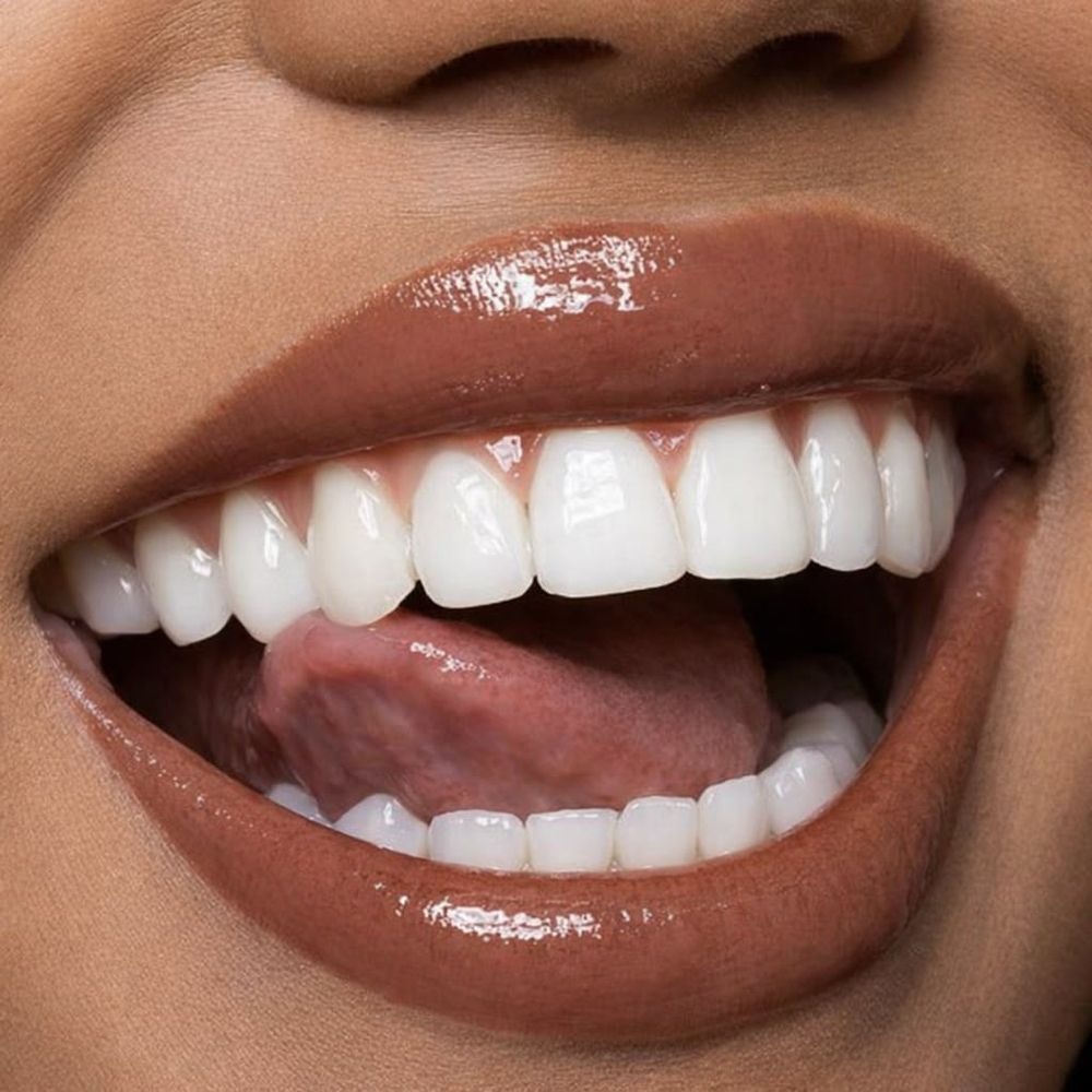30min Teeth Whitening at Brows By Dom in Greeley, CO