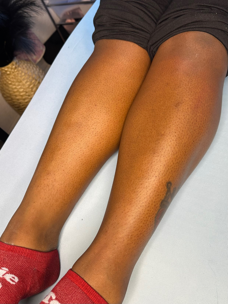Legs