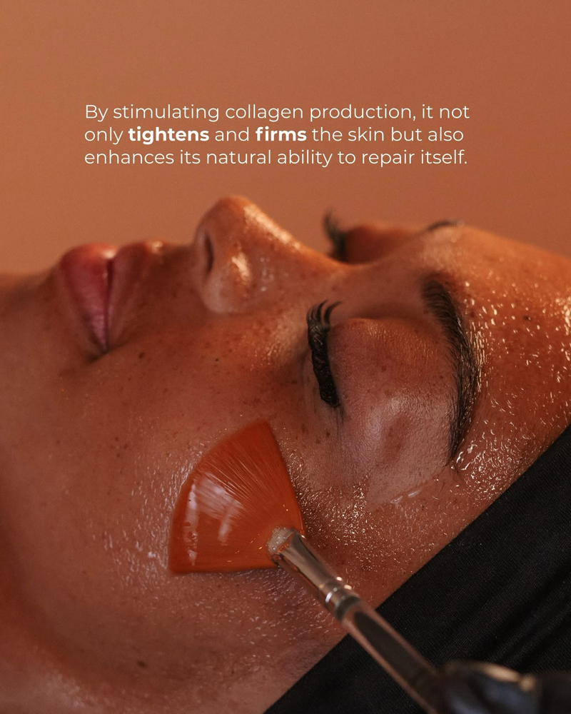 The Vitamin C Radiance Facial at The Skin Therapist Esthetics & Waxing-Kayla Spencer in Union City, TN