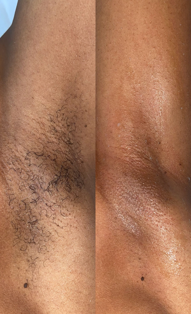 Underarm Wax
