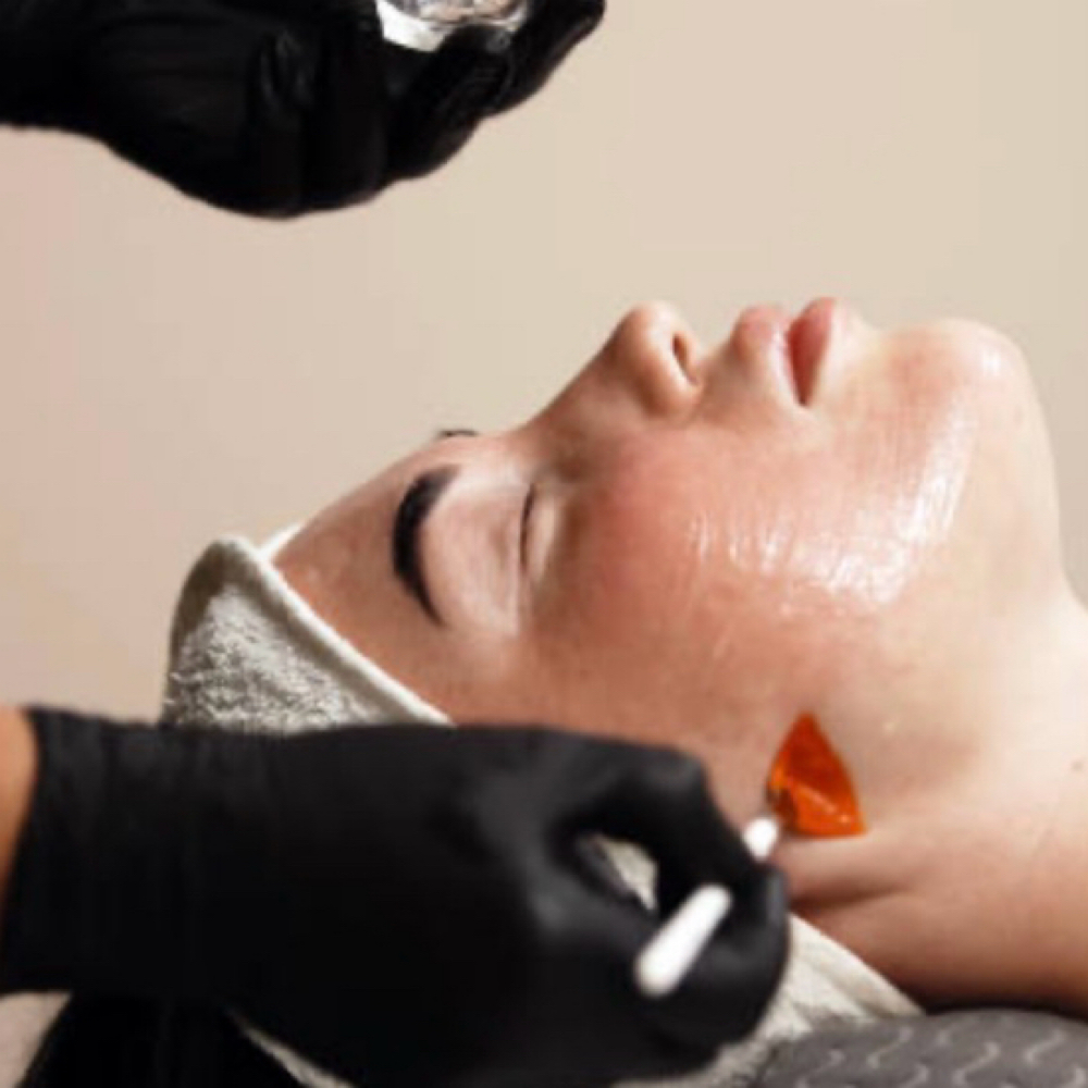 Add-on PCA Peel at Beach Cottage Day Spa in Seal Beach, CA