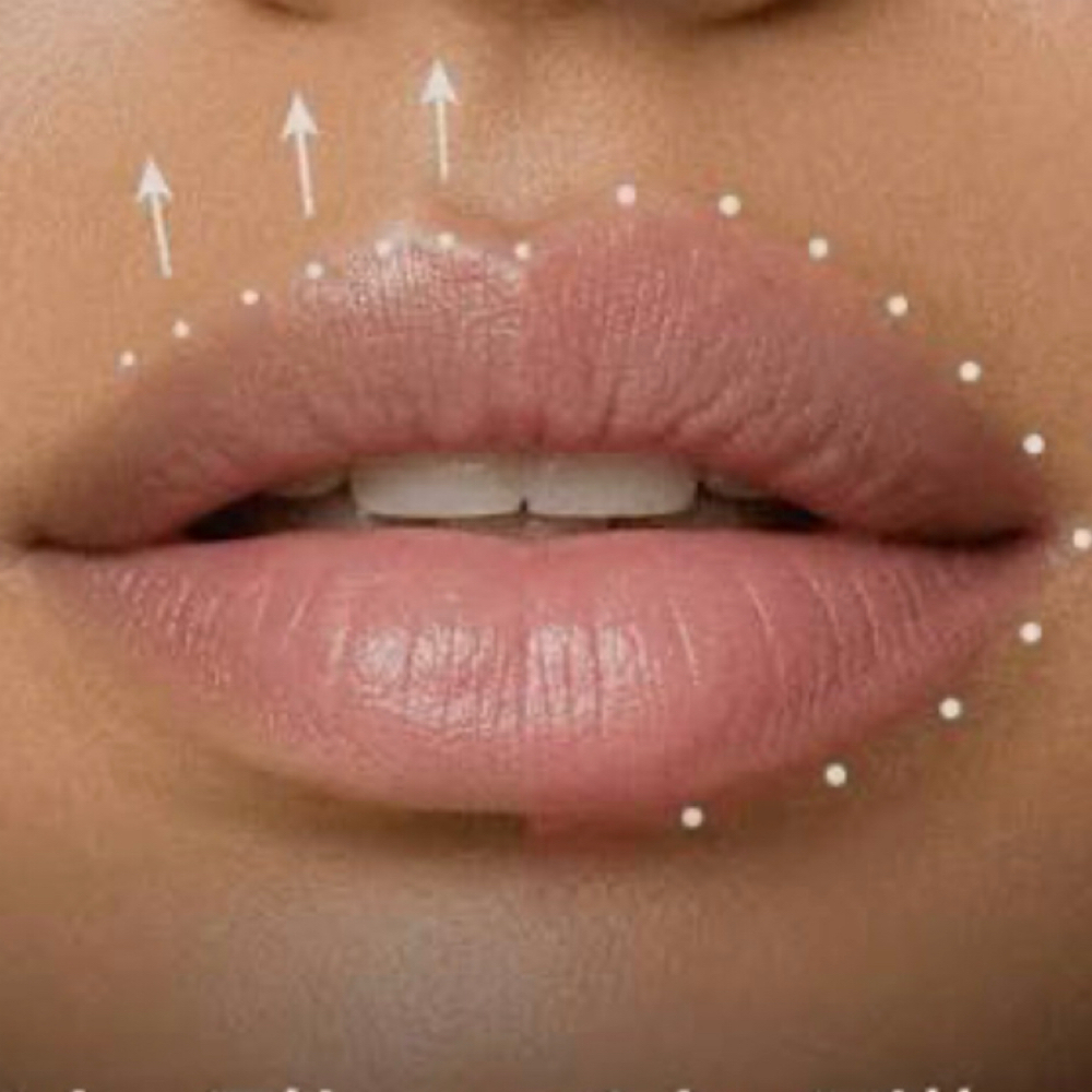 Lip Flip at Lyla James Aesthetics and Wellness in Pryor, OK