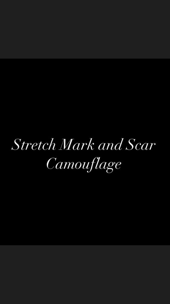 Stretch Mark/Scar Camouflage