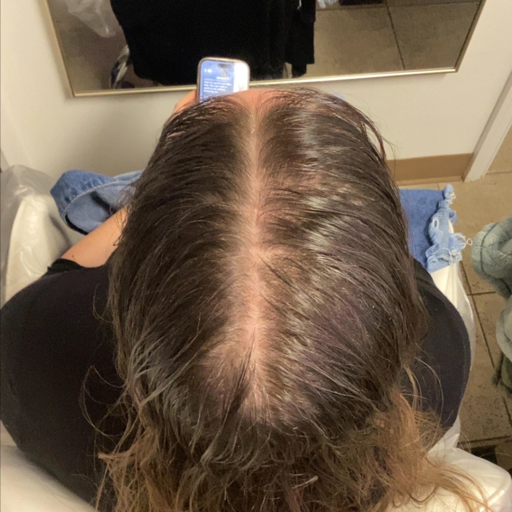 EPIGENETIC HAIR FOLLICLE ANALYSIS at SkinFinity Scalp & Facial Studio in Berlin, CT