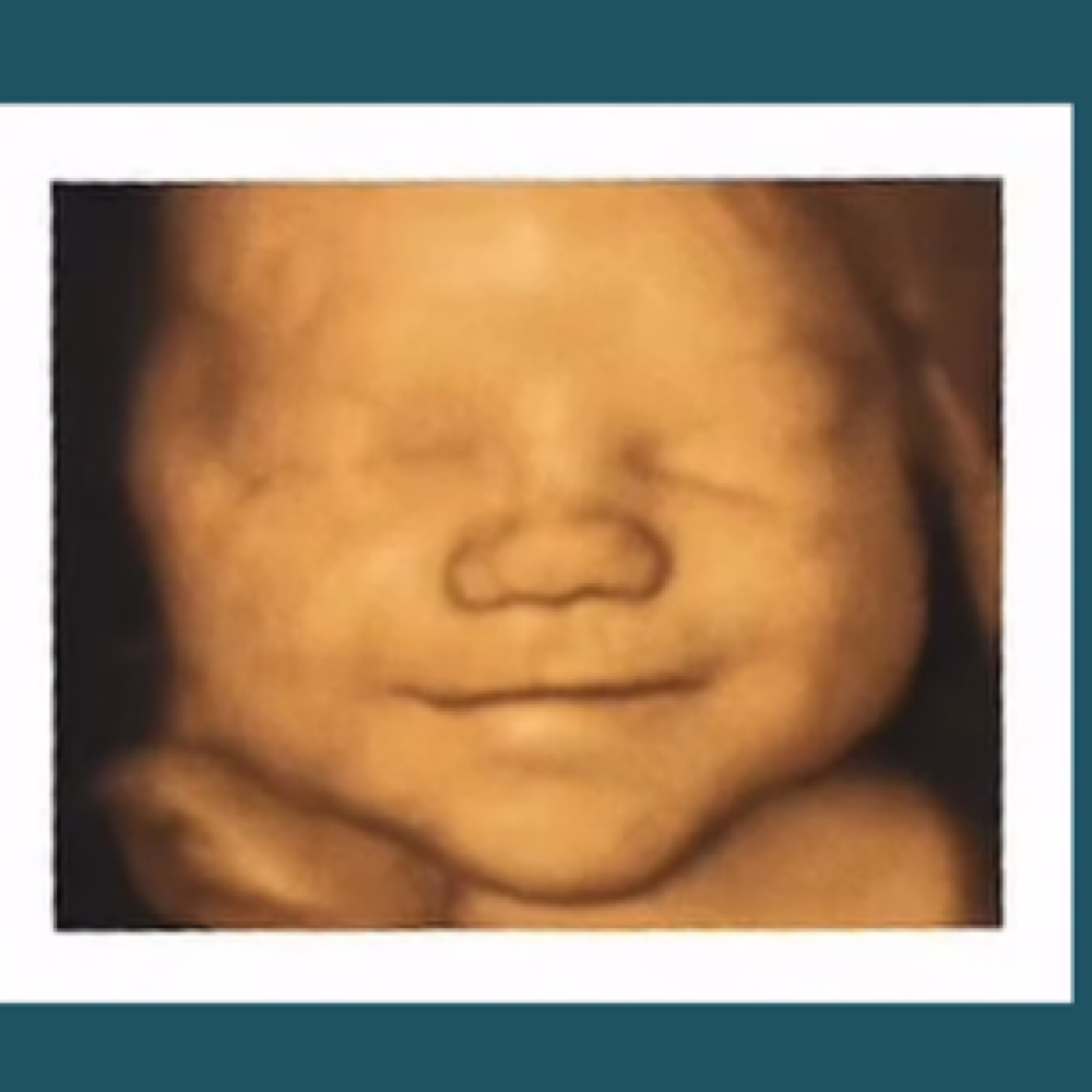 3D4D Sale at Babyview 3D4D Imaging in Palmdale, CA