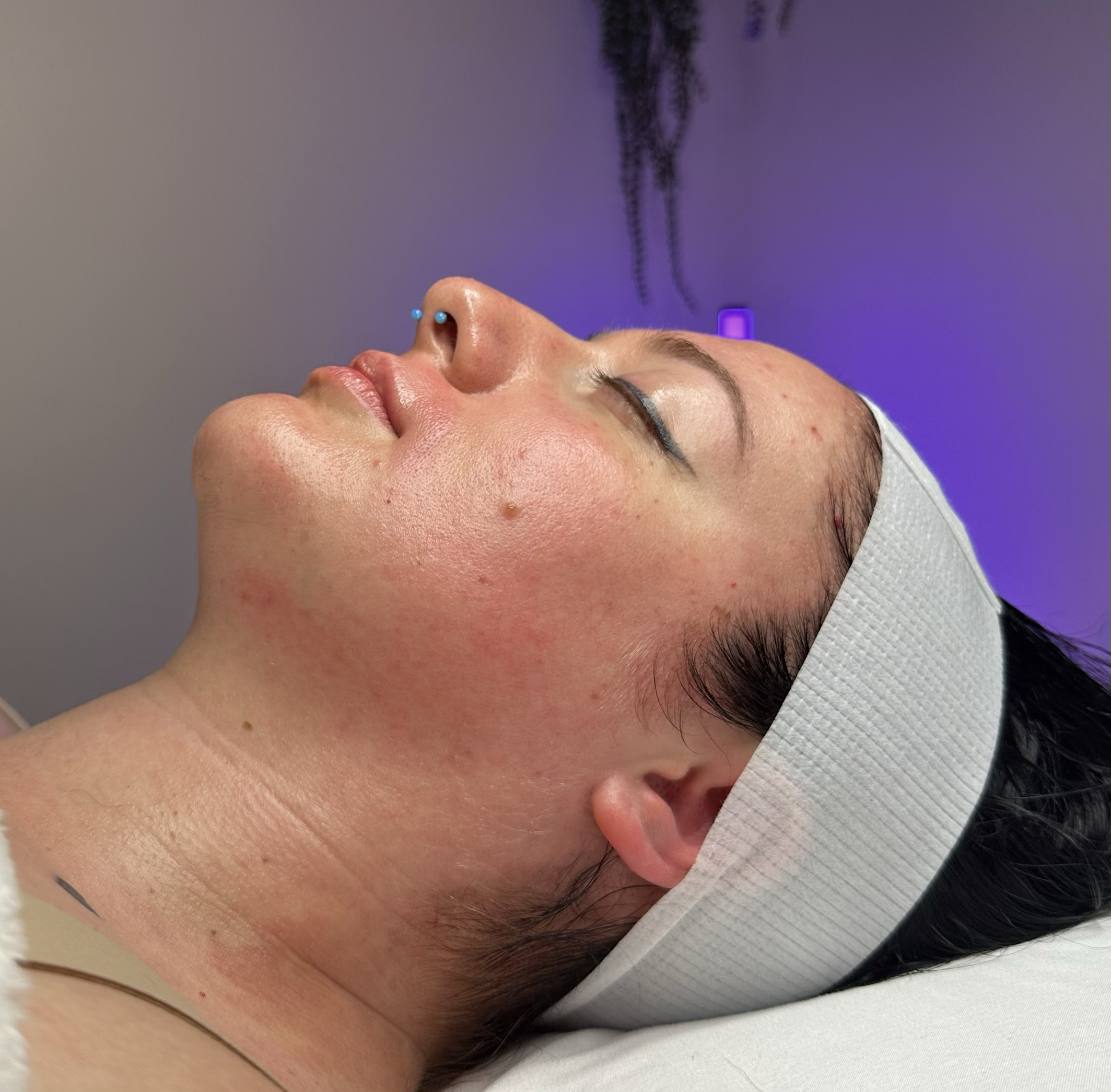 Custom Facial