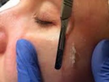 DermaGlow Facial (Dermaplane)