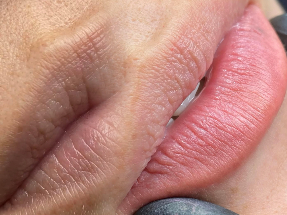 Dark Lips Newtralization